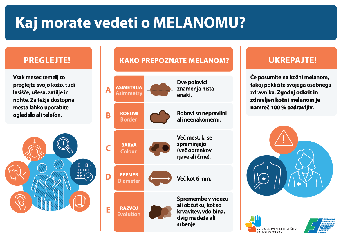 melanom 2